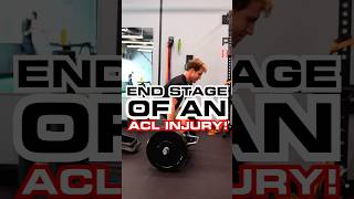 Maximize Your ACL Recovery [upl. by Annahsar]