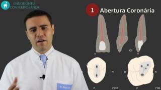 Preparo do Canal Radicular Com Segurança E Qualidade Em 5 Passos [upl. by Hannala831]