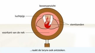 Keelontsteking  de oorzaak en behandeling [upl. by Htrowslle445]