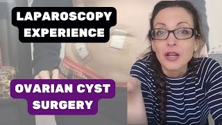 Laparoscopy surgery experience  Ovarian Cyst removal [upl. by Gridley50]