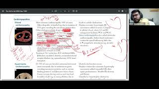 CVS PATHO PART3 CARDIOMYOPATHIES FIRST AID USMLE STEP1 URDUHINDI [upl. by Queena]