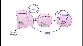 USMLE ACE Video 77 Caseating and NonCaseating Granuloma [upl. by Ardnossak]