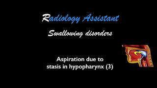 Swallowing disorders  Aspiration 3 [upl. by Aihseuqram]