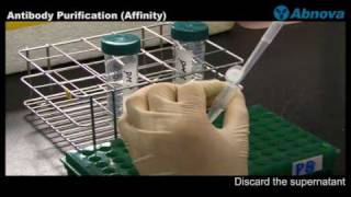 Antibody Purification Affinity [upl. by Aidnic409]