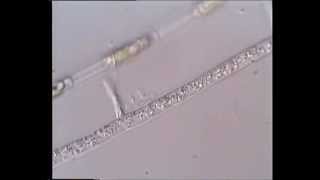 Cytoplasmic streaming in fungal hyphae [upl. by Aehsrop127]