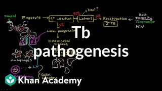 TB pathogenesis  Infectious diseases  NCLEXRN  Khan Academy [upl. by Ebsen410]