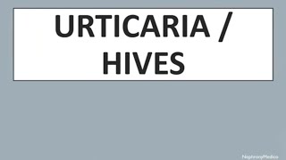 Urticaria  Hives  DERMATOLOGY  Rapid Revision  USMLE [upl. by Alfie]