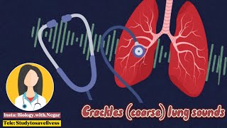 Coarse Crackles abnormal lung sounds  صدای ریوی کراکل خشن [upl. by Nnylassej]