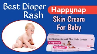 Best Diaper Rash Creams in 2023 Top 3 Best Diaper Rash Creams [upl. by Aynnek385]