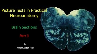 Picture Test in Neuroanatomy Brain Sections 3 [upl. by Kaleb]