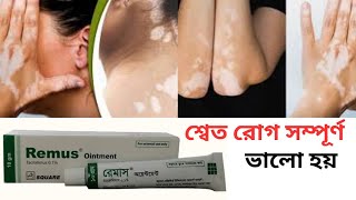 শ্বেত রোগ ভালো করার মলম  Remus Ointment  Tacrolimus 01 [upl. by Atikcir]