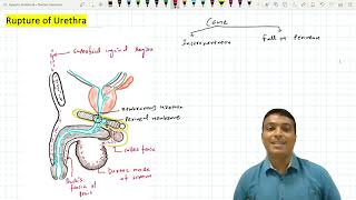 Urethral Rupture [upl. by Tanah]