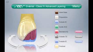 GC Composite Restorative Guide [upl. by Eilloh]