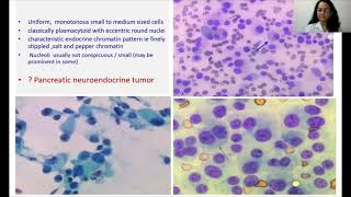 LG PathLab webinars  Unusual pancreatic tumours  Cytology diagnosis and approach [upl. by Asyl]