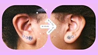 How ToTreat An Infected Ear Piercing [upl. by Cly]