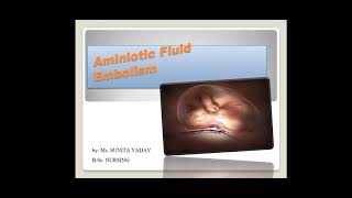 Amniotic Fluid Embolism [upl. by Marena]