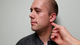 Chvosteks Sign of Hypocalcemia Facial Nerve Tapping [upl. by Ahsirtak]