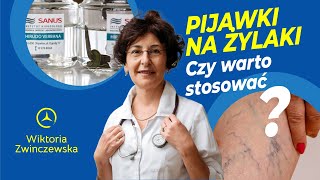 Pijawki Na Żylaki Czy Warto Stosować Pijawki Na Żylaki [upl. by Hogarth]