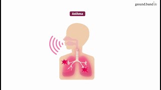 Was ist Asthma [upl. by Frederique]