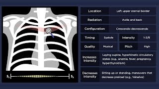 Pulmonary Flow Murmur [upl. by Enelime]