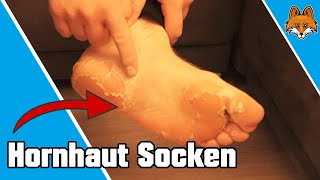 Hornhaut Socken  So einfach Hornhaut entfernen 👣✅ [upl. by Norok]