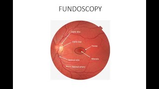 HOW TO DO FUNDOSCOPY OR OPHTHALMOSCOPY [upl. by Eoin]