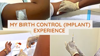 My Birth Control Implant Experience  Jadelle amp Levoplant  Ariannes World [upl. by Eanar968]