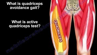 ACL PCL amp Quadriceps  Everything You Need To Know  Dr Nabil Ebraheim [upl. by Nilrem]