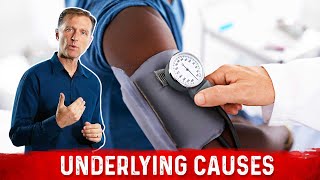 What Causes Low Blood Pressure – DrBerg [upl. by Anigar427]