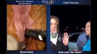 Cervical Deuk Laser Disc Repair vs Anterior Cervical Discectomy amp Fusion [upl. by Gaut664]