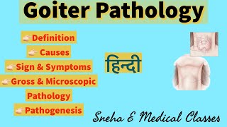 Goiter  Hindi  Pathogenesis  Gross amp Microscopic pathology [upl. by Nelyak44]