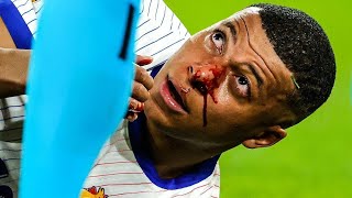 Kylian Mbappe Injury  Kylian Mbappe suffers broken nose after collision with Austrias Kevin Danso [upl. by Schechter284]