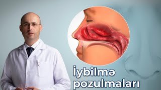 Uzman Dr Elnur Əkbərov  İybilmə pozulmaları [upl. by Hedda89]