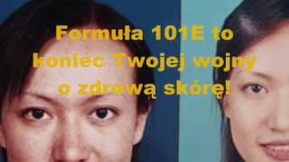 Formuła 101 E  Ostateczne Rozwiązanie Kwestii Trądziku [upl. by Bernadene73]