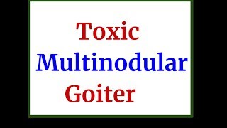 Toxic Multinodular Goiter [upl. by Filmore]