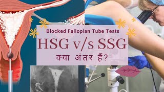 बांझपन के लिए SSG vs HSG Test HSG Aur SSG Test kab karte hain Infertility Treatment in Delhi NCR [upl. by Anidam]