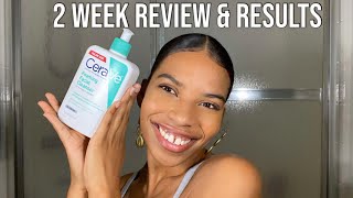 CeraVe Foaming Facial Cleanser Review  Is it worth the hype [upl. by Tsuda406]