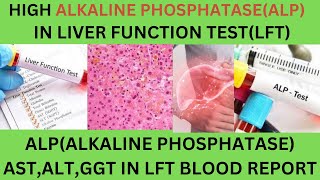 Liver Function Test Report Interpretation LFTsASTALTALP CAUSES OF HIGH LOW ALKAINE PHOSPHATASE [upl. by Barker]