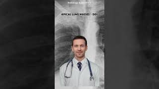 Apical Lung Masses Differential Diagnoses radiology everywhere [upl. by Aicekal357]