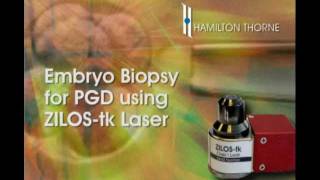 Blastomere Biopsy using ZILOStk Laser [upl. by Llesram450]