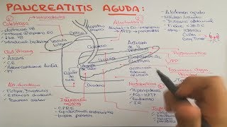 Pancreatitis causas fisiopatología clínica diagnóstico y tratamiento [upl. by Mcquoid]