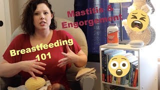 Mastitis and Engorgement  Lactation Consultant  Nurse Whit [upl. by Aciria630]