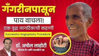 Angioplasty Success Story Senior Citizens Recovery from Gangrene and Blockage by Dr Amol Lahoti [upl. by Dorthy]