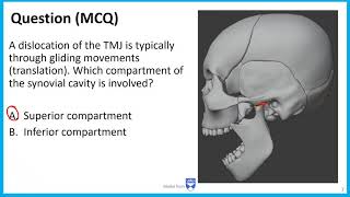 Anatomy of Temporomandibular joint  TMJ  Animation Gross Anatomy medical animations [upl. by Anidan]