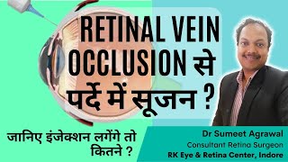 RETINA की नस BLOCK होने पर Retinal Vein Occlusion कितने INJECTION लगेंगे [upl. by Katherina967]