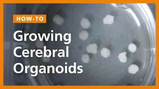 How to Grow Cerebral Organoids from Human Pluripotent Stem Cells [upl. by Harmony816]