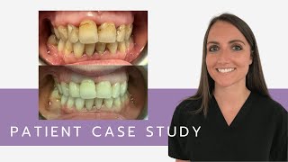 Patient Case Study With Jane [upl. by Aninaj686]