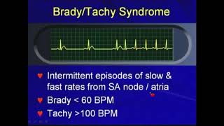 51c BradyTachy Syndrome  Bradyarrhythmias Hong Kong University [upl. by Ethbinium]