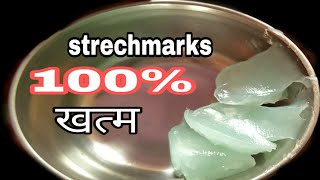 3 दिन में स्ट्रेच मार्क्स को जड़ से खत्म कर देगा ये नुस्खा  Stretch Marks Remove in 3 Days [upl. by Nolahs]