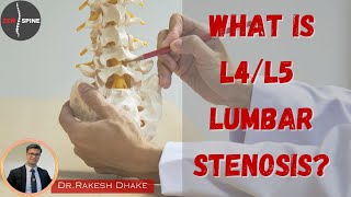 What is L4L5 Lumbar Stenosis [upl. by Ytisahc]